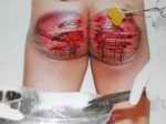 Bloody result of flogging